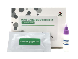 AntigenNsetestCOVID1925stk-20