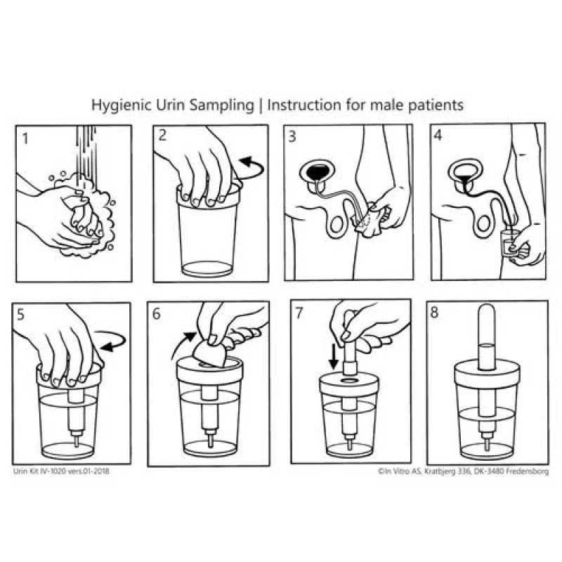 UrinkitmedVformetrrberringsfritvakuumsystemCEogIVDcertificeret50kit-02